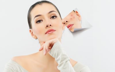 Was Pickel über Deine Haut sagen