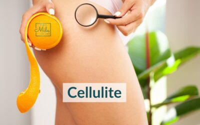 Cellulite